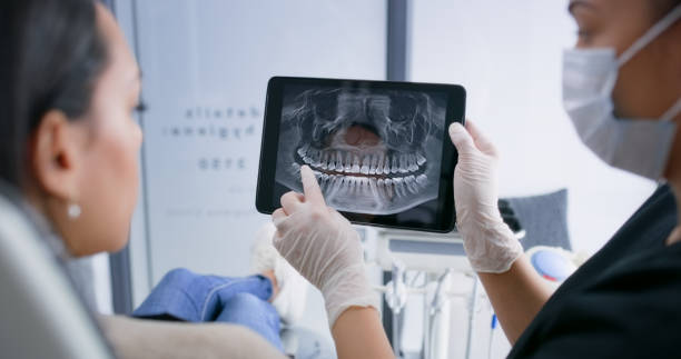 Licensed Wisdom Tooth Removal service in Sidney, MT - Smile Center Dentistry